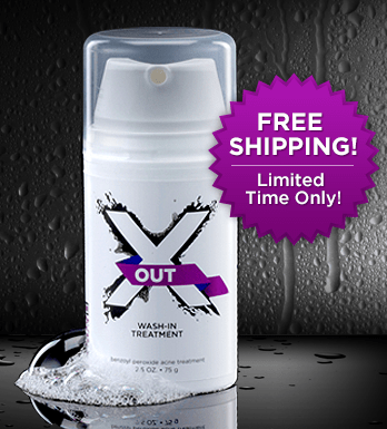 XOut Review #MC #sponsored x