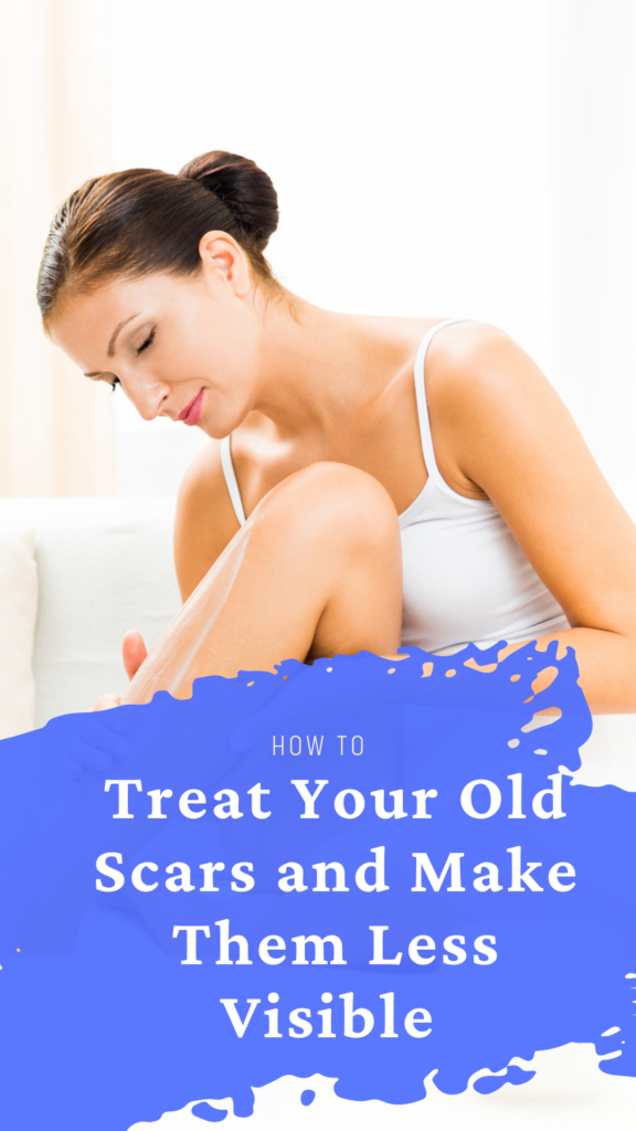 How to Treat Your Old Scars and Make Them Less Visible How to Treat Your Old Scars and Make Them Less Visible