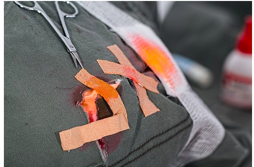 How To Deal With Trauma Caused By A Work-Related Accident? How To Deal With Trauma Caused By A Work-Related Accident?