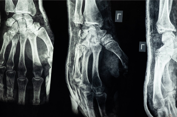 How To React To A Personal Injury? How To React To A Personal Injury?